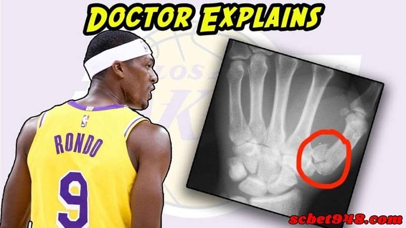 傷兵名單nba